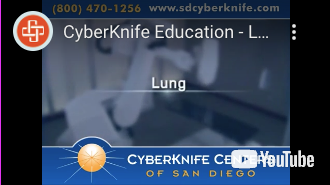 Cyberknife Education Video Lung Cancer