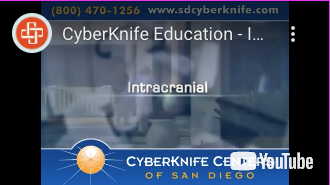 Cyberknife Educational Video Intercranial