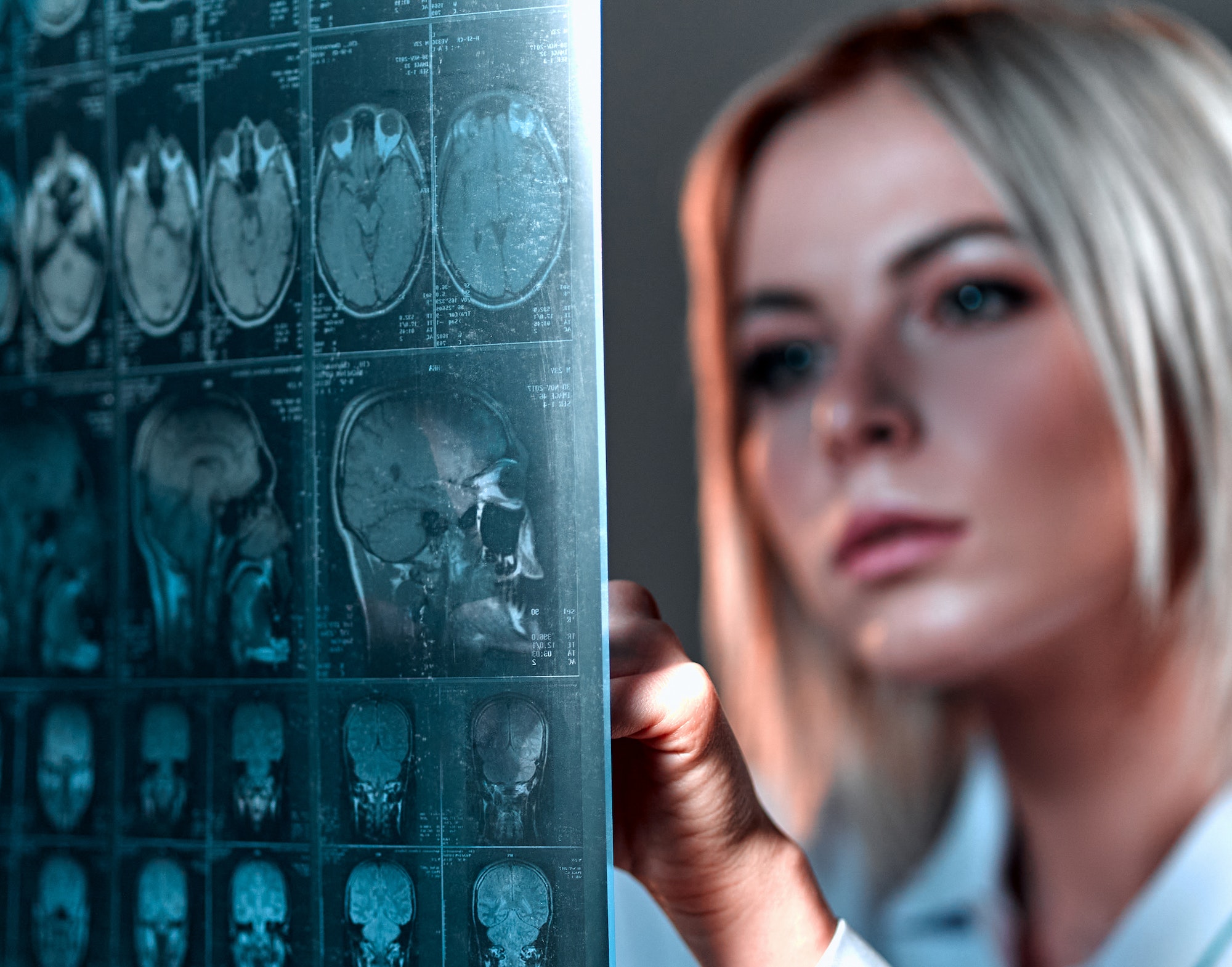A young blond woman doctor dressed in a white uniform examines an MRI of the brain.